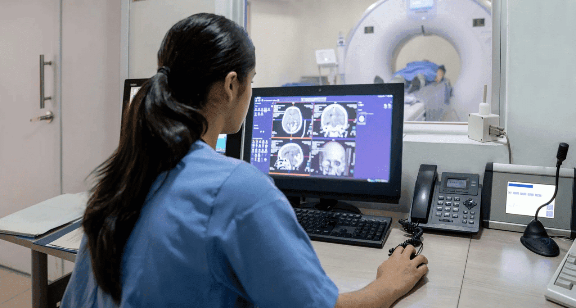 Mudanças cerebrais na menopausa lembram padrões do Alzheimer